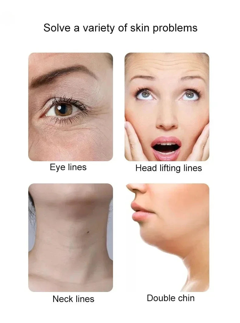 Electric Radio Frequency Apparatus Color Light Gua Sha Tools EMS Facial Lifting Vibration Massage Apparatus Neck Beauty Apparat