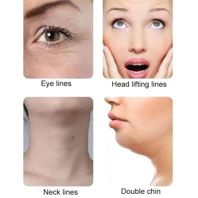 Electric Radio Frequency Apparatus Color Light Gua Sha Tools EMS Facial Lifting Vibration Massage Apparatus Neck Beauty Apparat